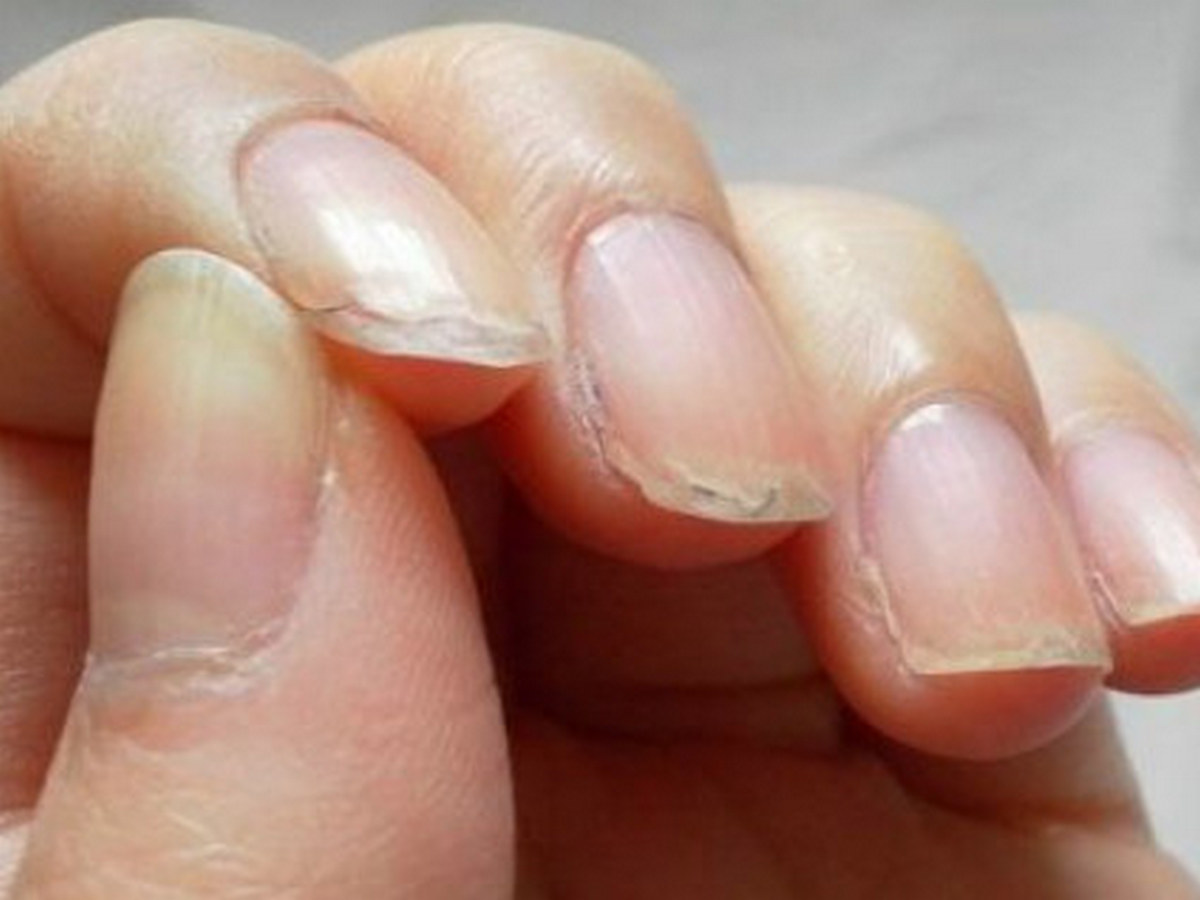 Ce ne pot transmite schimbările vizibile ale pielii și unghiilor